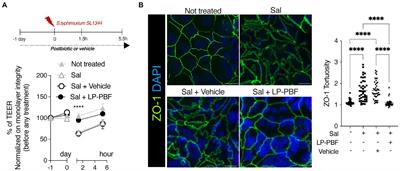 Lactobacillus paracasei CNCM I-5220-derived postbiotic protects from the leaky-gut